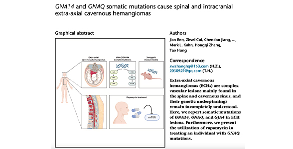 成果发表｜洪韬/张鸿祺教授团队发现轴外海绵状血管瘤遗传机制和雷帕霉素的治疗效果
